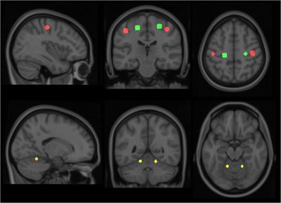 Cortical Plasticity After Surgical Tendon Transfer in Tetraplegics